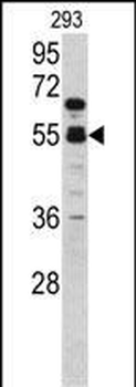 F10 Antibody (C-term)抗体，orb369