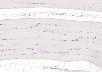 Cardiac Troponin I/TNIC Mouse 