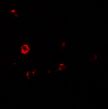 IL-1RL2 Antibody抗体，orb1239672，