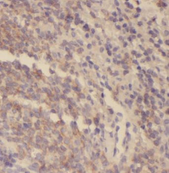 SYK Antibody抗体，orb631664，biorb