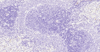 Tau-4 Mouse Monoclonal Antibod