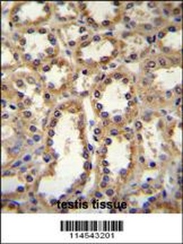 GPC6 Antibody抗体，orb1270040，bio