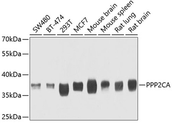 PPP2CA Antibody抗体，orb1256835，b