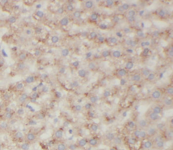 ST7 Antibody抗体，orb631545，biorb