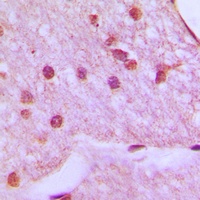 HOXA1 Antibody抗体，orb214046，bio