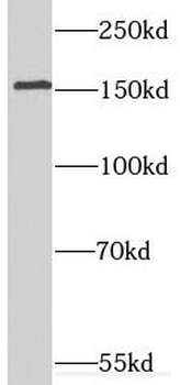 SYNGR2 Antibody抗体,orb631668,bi