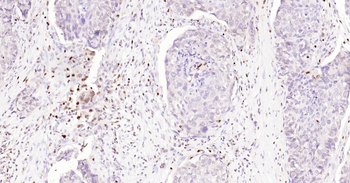 5 Lipoxygenase Recombinant Rab