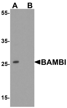 BAMBI Antibody抗体，orb1240142，bi