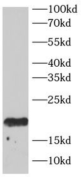 HRAS Antibody抗体，orb756623，bior