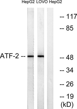 ATF-2 rabbit pAb抗体，orb764597，b