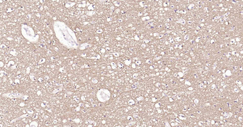 Tau-4 Mouse Monoclonal Antibod