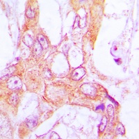 PDLIM1 Antibody [KO/KD Validat