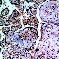 Inhibin alpha Antibody抗体，orb25