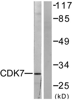 Cdk7 rabbit pAb抗体，orb764818，bi