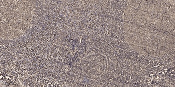 ATF-5 rabbit pAb抗体，orb764598，b