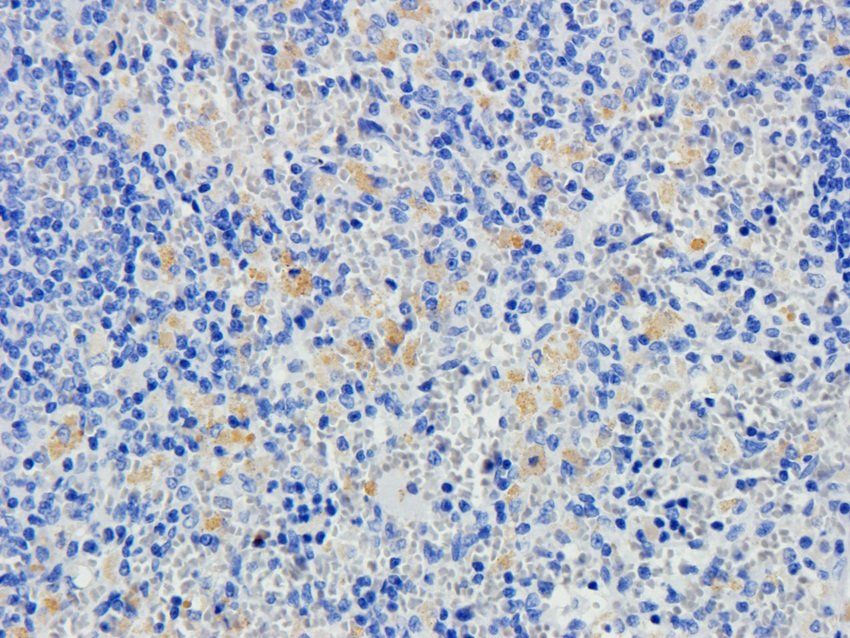 LAG3 antibody抗体，orb6286，biorby