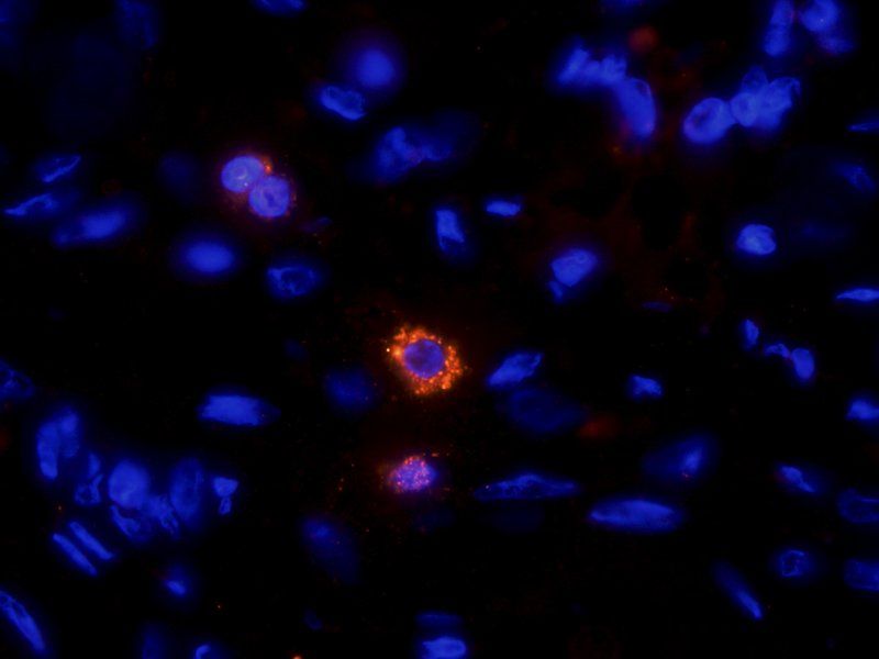 HE4 antibody抗体，orb101171，biorb