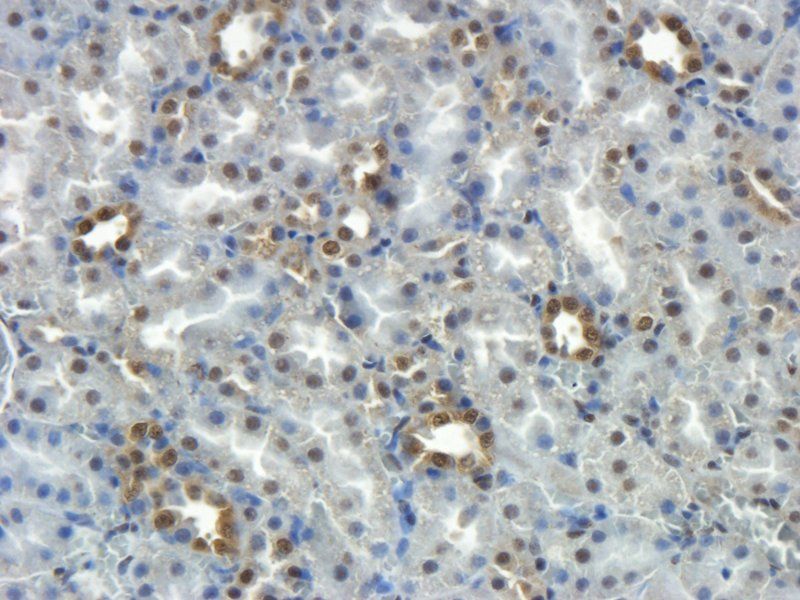 beta 1 Adrenergic Receptor ant