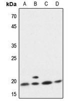 p18 INK4c Antibody抗体，orb213720