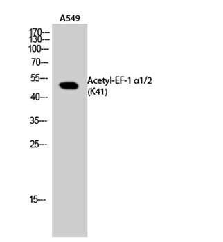 EF-1 α1/2 (Acetyl Lys41) rabbi