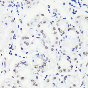 Symmetric DiMethyl-Histone H3-