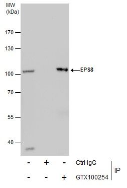 EPS8 antibody [C3], C-term抗体，o