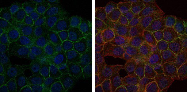 BLNK Antibody抗体，orb69446，biorb