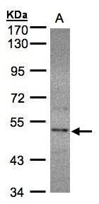 SEPHS2 antibody [N3C3]抗体，orb55