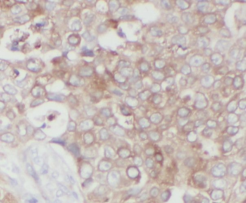 STC2 Antibody抗体，orb631556，bior