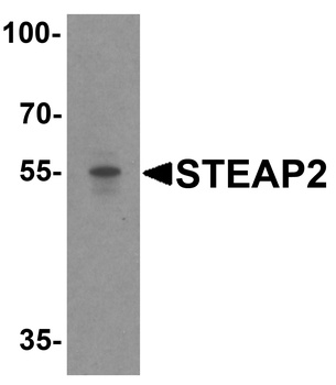 STEAP2 Antibody抗体，orb1238877，b