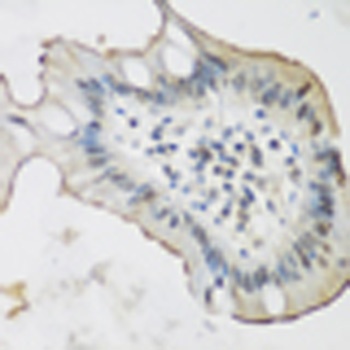 ALOX15 Antibody抗体，orb1255089，b