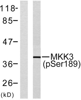 MEK-3 (phospho Ser218) rabbit 