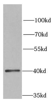 SFRP4 Antibody抗体,orb631112,bio