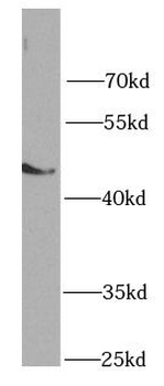 SHH Antibody抗体，orb631169，biorb