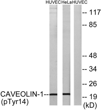Caveolin-1 (phospho Tyr14) rab