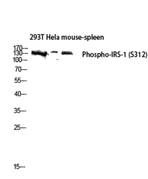 IRS-1 (phospho Ser312) rabbit 