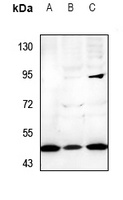 Cytochrome P450 21A2 Antibody抗