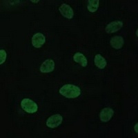 TFIIE-alpha Antibody抗体，orb6668