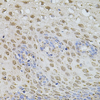 ELP3 Antibody抗体，orb1255536，bio