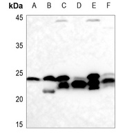 Cyclophilin F Antibody抗体，orb21