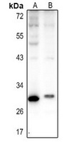 Carbonic Anhydrase 1 Antibody抗