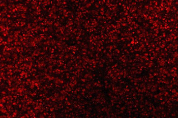 AREB6/ZEB1 Antibody (monoclona