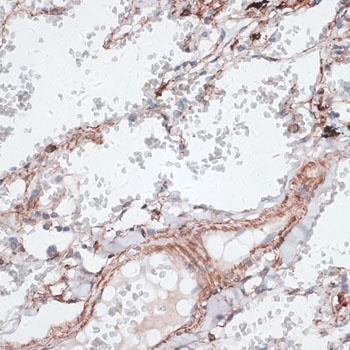 Vimentin Antibody抗体,orb1258103