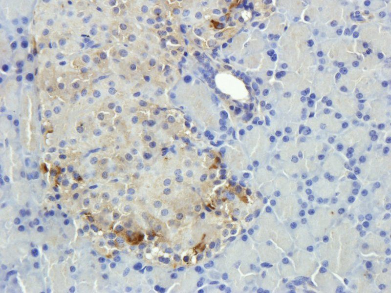 CD20 antibody抗体，orb10307，biorb