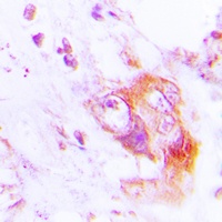 PKR (Phospho-T451) Antibody抗体,