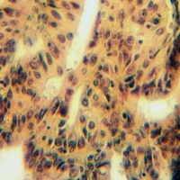 MYOM2 Antibody抗体,orb214872,bio