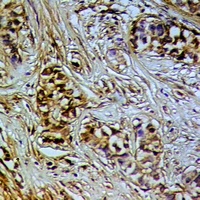 DNA Polymerase iota Antibody抗体