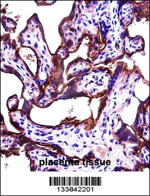 ALPPL2 Antibody抗体，orb1268920，b