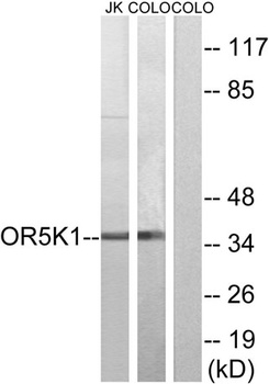 Olfactory receptor 5K1 rabbit 