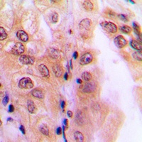 PPP2R5D Antibody抗体，orb304517，b